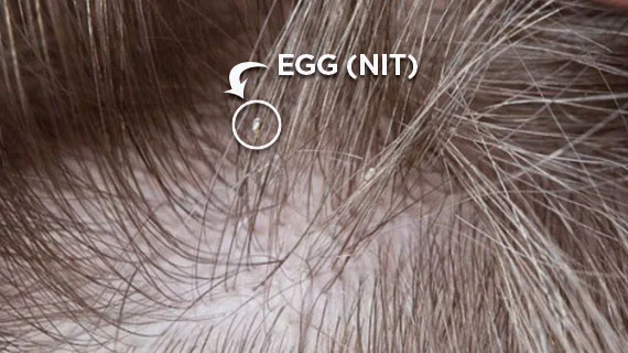 close up picture of the Egg (NIT)