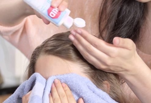 Parent using rid lice shampoo on child in Spring Grove Illinois
